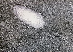 Pseudomonas aeruginosa Pseudomonas aeruginosa